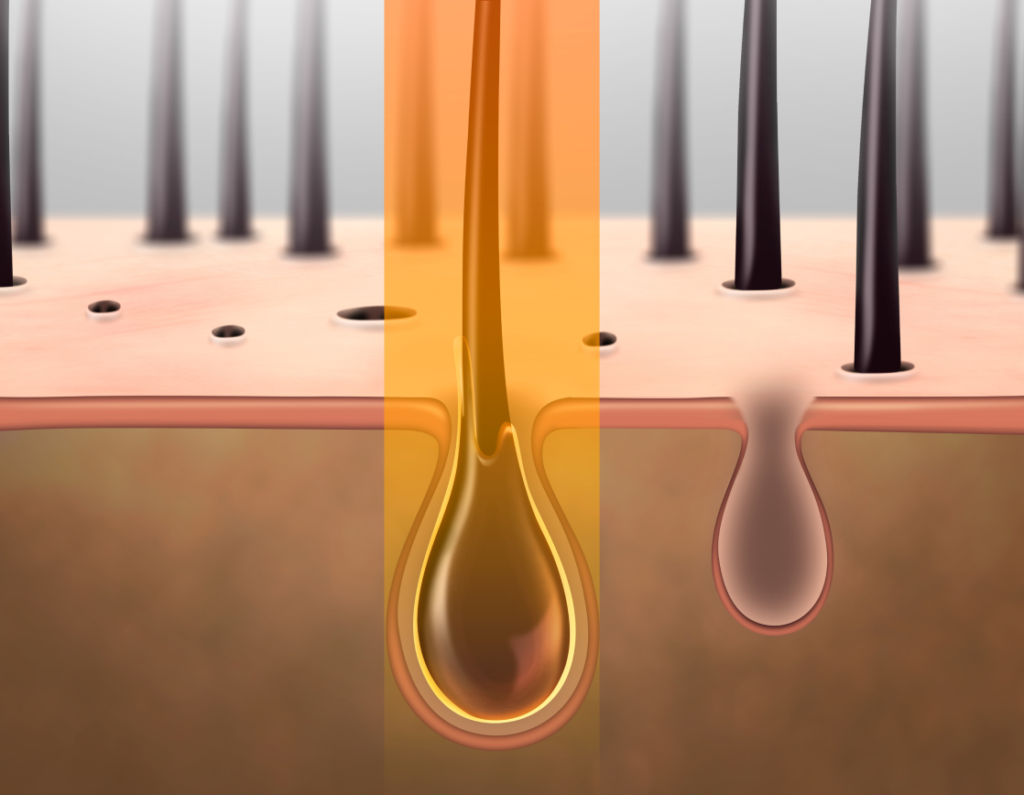 체모 감소와 재성장 억제 효과를 표현한 아포지 플러스 레이저 제모 효과 설명 이미지