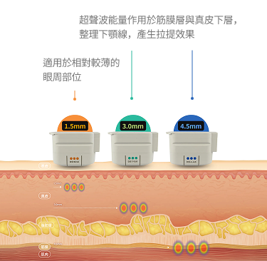 超音波能量在皮膚結構中作用深度分別為 4.5 毫米、3.0 毫米和 1.5 毫米時的橫斷面影像。