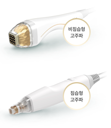 비침습형과 침습형 고주파 시술 방식을 비교해 설명하는 포텐자 시술 유형 비교 이미지