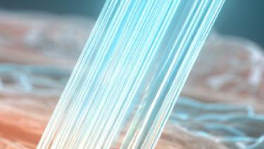 강력한 냉각 시스템으로 통증과 피부 자극을 줄이는 아포지 플러스 쿨링 구조 설명 이미지