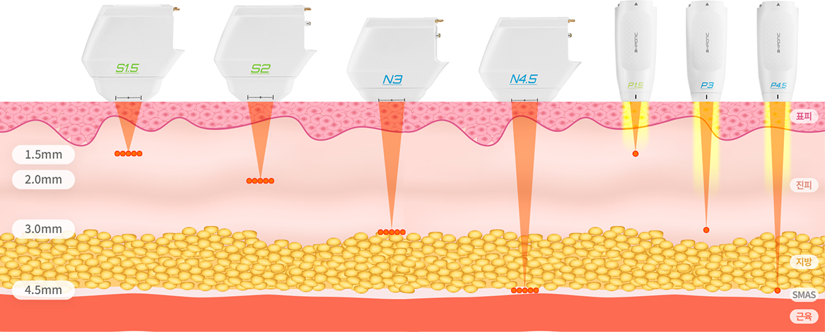 FL 카트리지와 SD 카트리지를 포함한 브이로 리프팅 카트리지 종류를 보여주는 이미지
