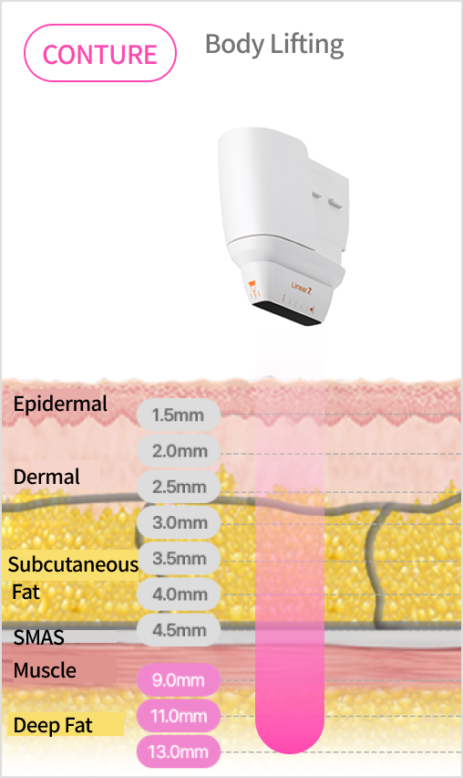 Image explaining the linear structure that precisely targets the dermis and SMAS layers by adjusting the cartridge depth.