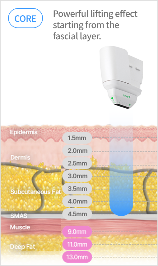 Image illustrating the ultrasound structure that uses a cartridge with a depth of 9 to 13 mm to target specific body parts.