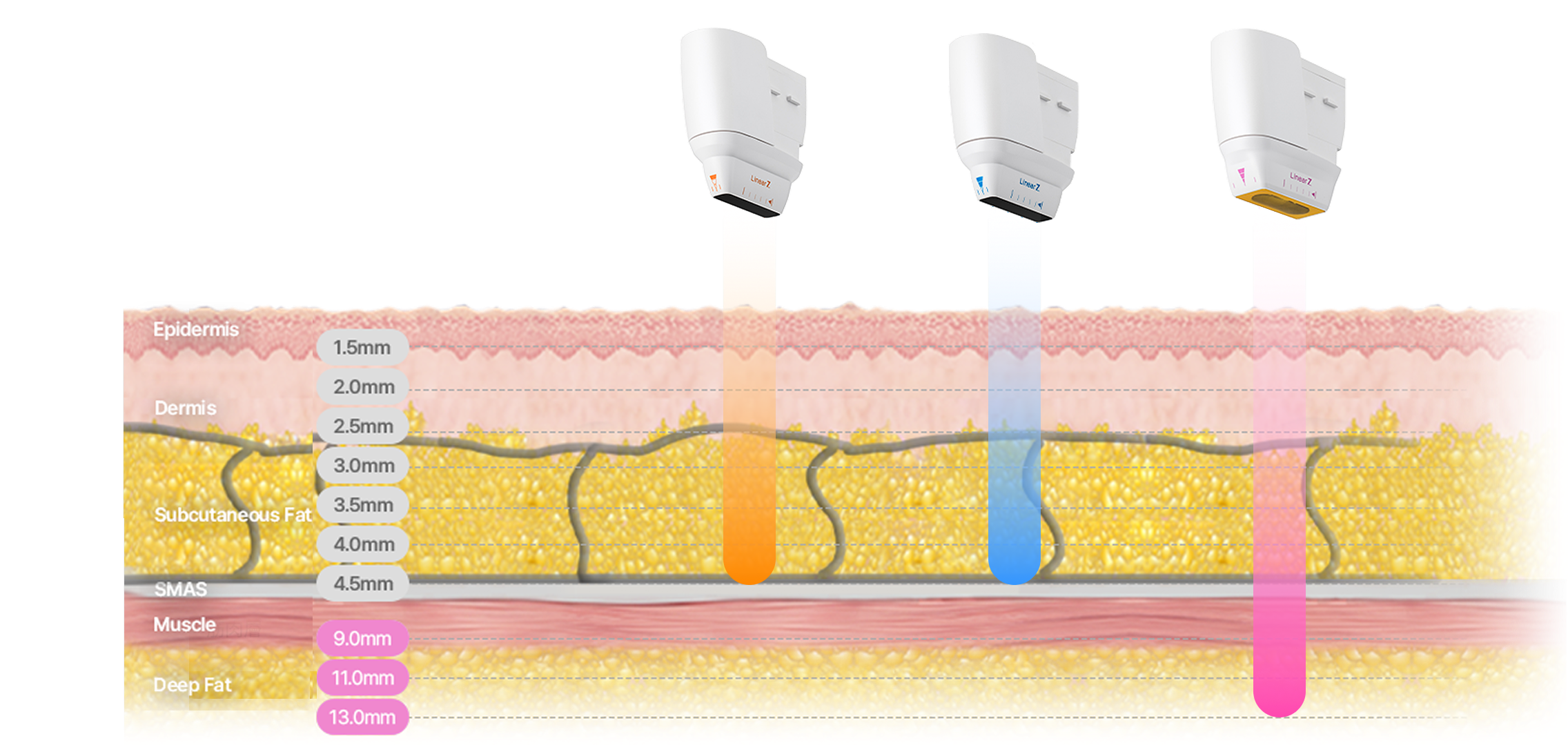 Image illustrating the ultrasound structure that uses a cartridge with a depth of 9 to 13 mm to target specific body parts.