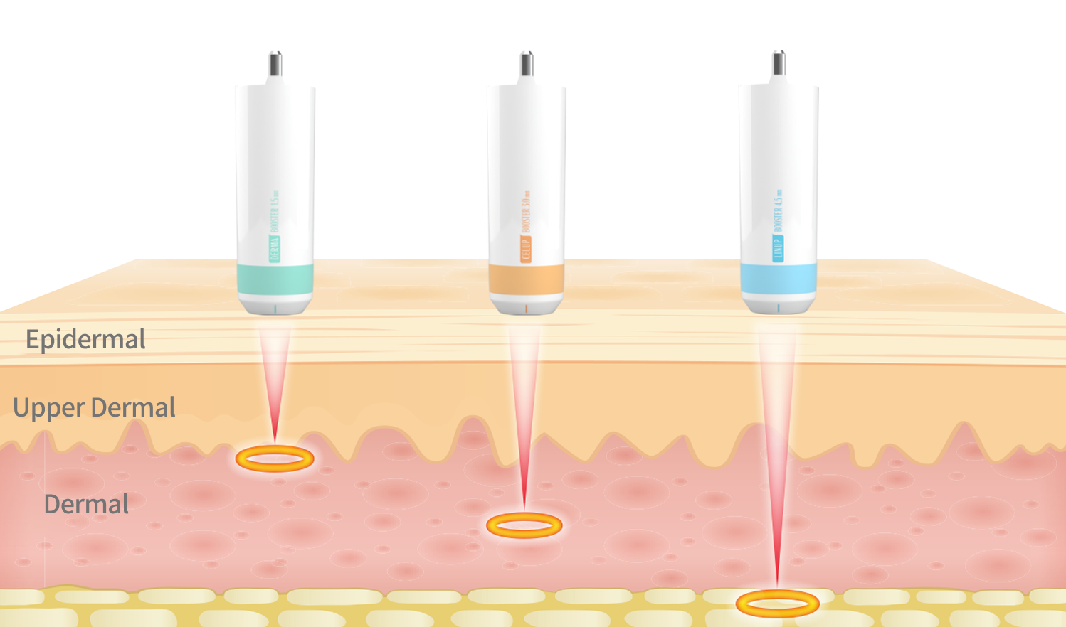 Shrink Universe cartridge guide image comparing various cartridges from 1.5mm to 4.5mm