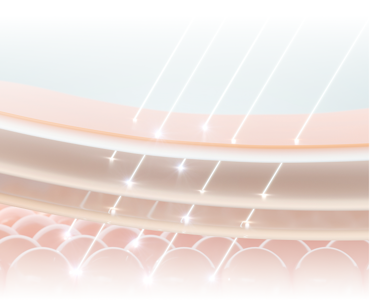 단극성 고주파 에너지가 진피층에 전달되는 과정을 시각화한 피부 단면 일러스트