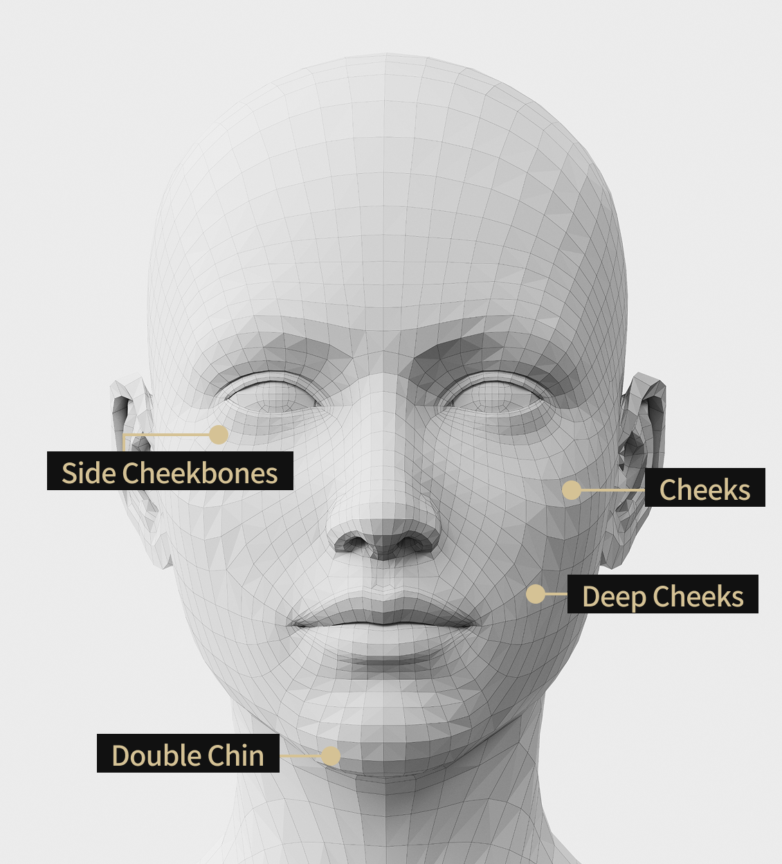 3D facial model image showing the areas where Onda Lifting is applied