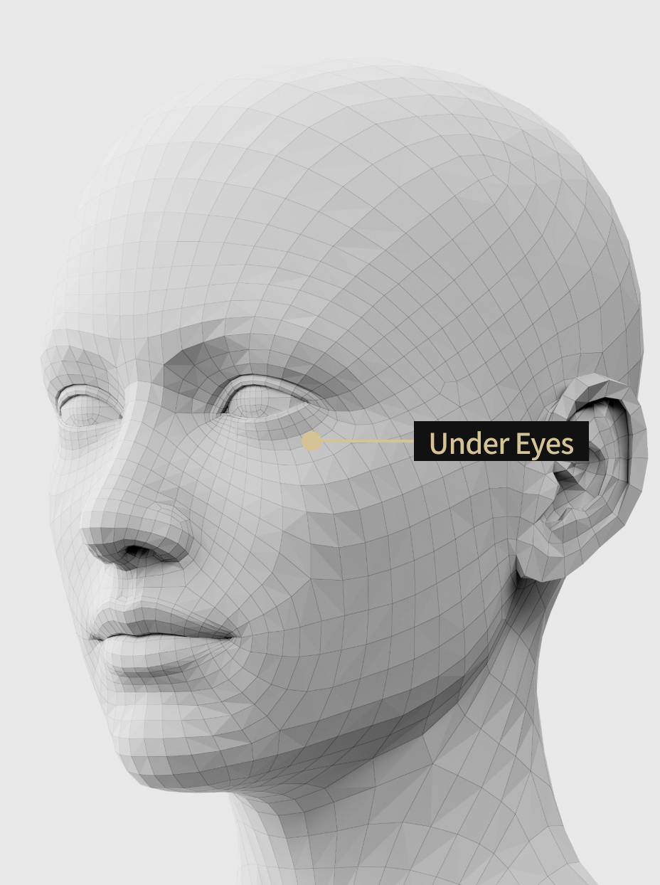 Image description of the area where under-eye filler is administered to improve hollowness and sagging under the eyes.