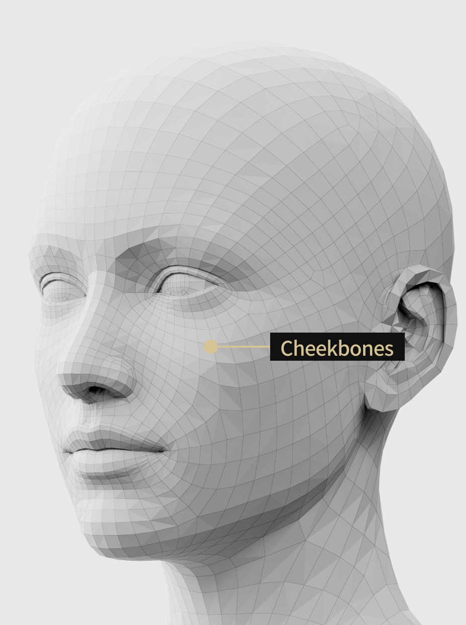 Image of filler treatment that adds volume to the cheekbones and creates a three-dimensional facial contour.