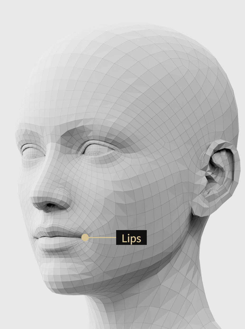 Image of a filler procedure that adds volume to the lips and corners of the mouth to improve the smile line.