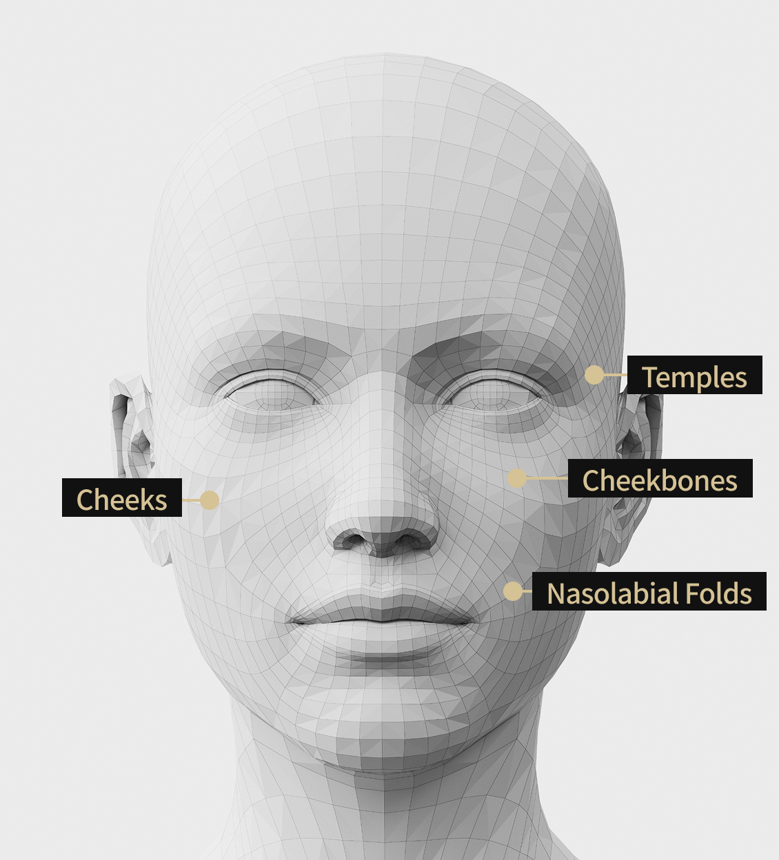 3D facial model image showing the areas where Sculptra was applied