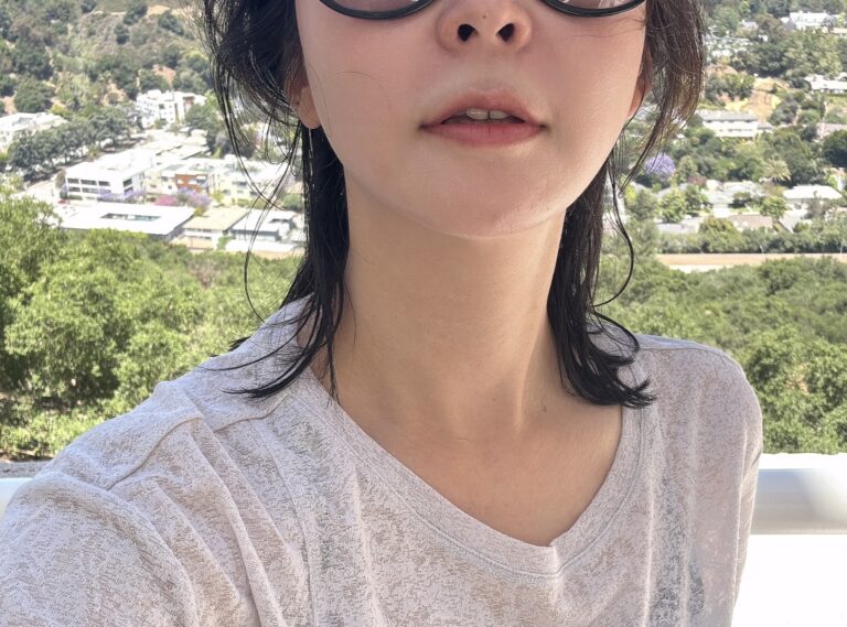 首のシワ改善 ベロテロ施術レビュー