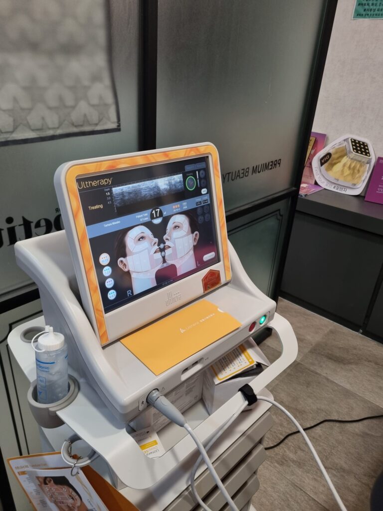 포텐자와 울쎄라