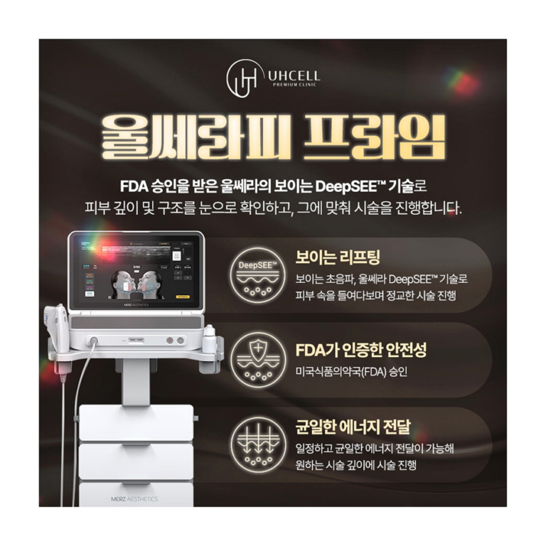 강남울쎄라피프라임 원리와 변화 기존과 차이점은?