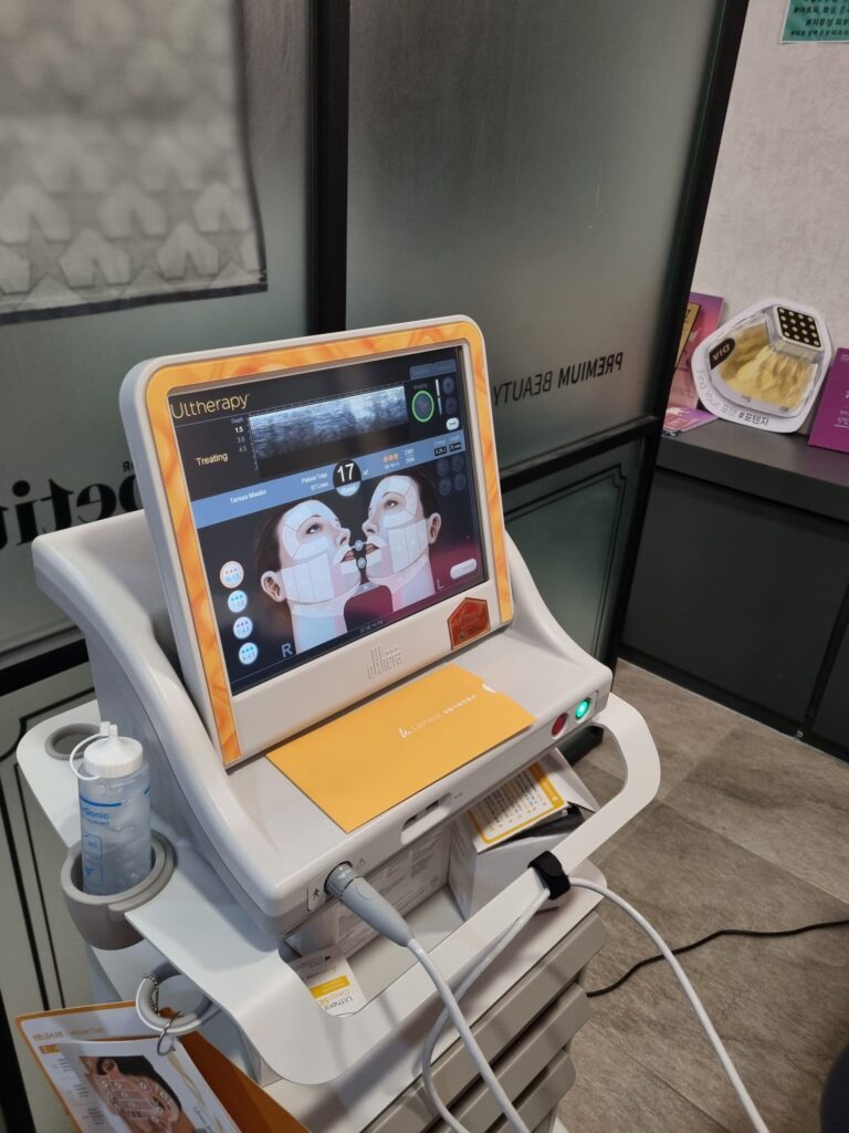 포텐자와 울쎄라