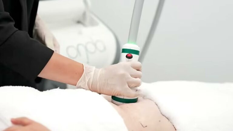 온다 바디로 체중이 줄까요? 국소 지방과 피부 탄력을 먼저 나눠 보는 이유