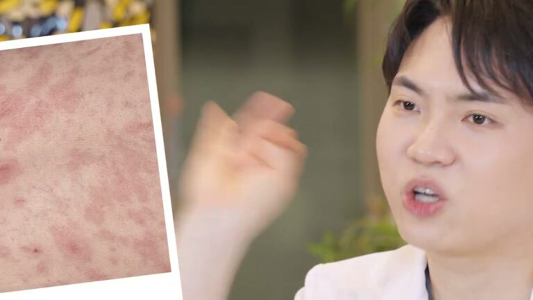 기미와 여드름 흉터, 어떤 순서로 치료해야 할까